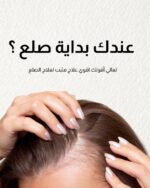 ⁦زيت عنايه الفروة⁩ - الصورة ⁦3⁩